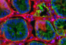 Nove simulacije i modeli raka bi mogli da ubrzaju medicinska istraživanja