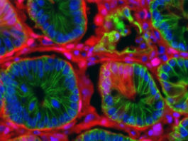 Nove simulacije i modeli raka bi mogli da ubrzaju medicinska istraživanja