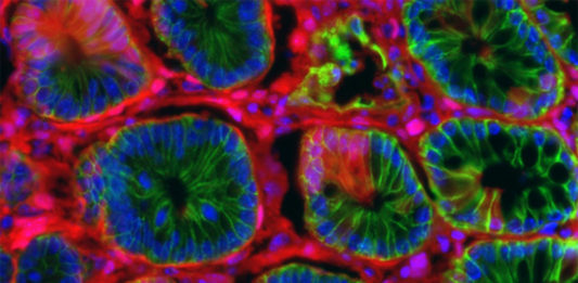 Nove simulacije i modeli raka bi mogli da ubrzaju medicinska istraživanja