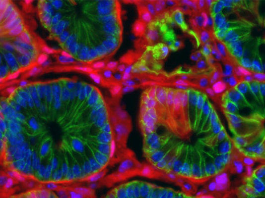 Nove simulacije i modeli raka bi mogli da ubrzaju medicinska istraživanja