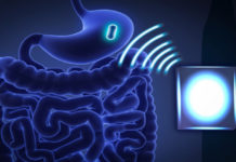 MIT razvija bežične uređaje za lečenje