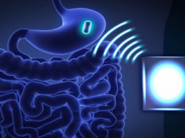 MIT razvija bežične uređaje za lečenje