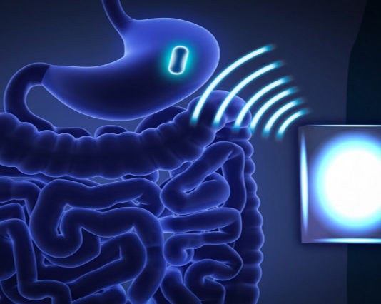 MIT razvija bežične uređaje za lečenje